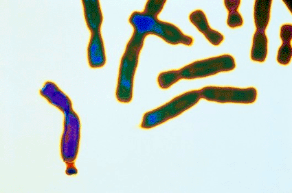 Image: Light micrograph of an X chromosome (purple) with fragile X syndrome, a genetic cause of mental retardation (Photo courtesy of CMSP).